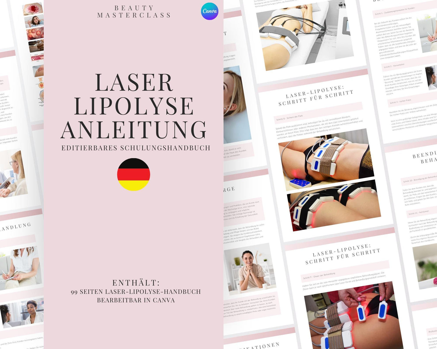 German Laser Lipolysis Editable Training Manual