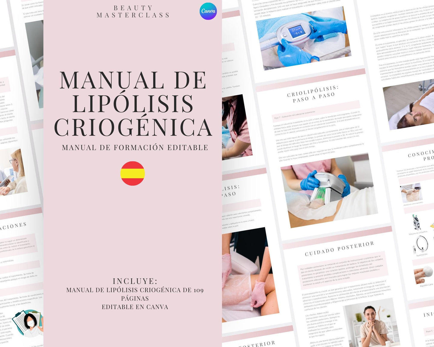 Spanish Cryolipolysis Editable Training Manual